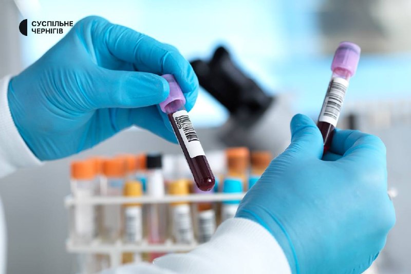 ВІЛ-інфекція, гепатити і сифіліс: скільки випадків виявили медики за 3 дні виїзної акції у Чернігові